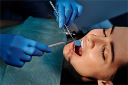 What Preventive Care General Dentistry Provides? | Sonoma